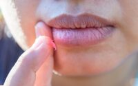 Les 3 meilleures huiles à lèvres naturelles selon la science