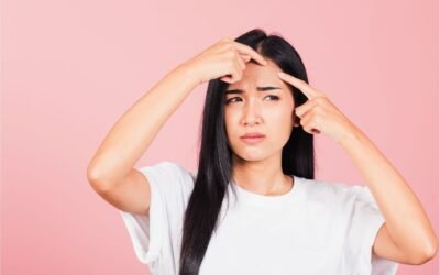 Quelles tisanes sont efficaces contre l’acné ?