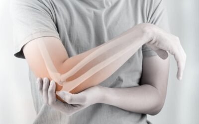Thé et ostéoporose : empêche-t-il la fixation du calcium ?